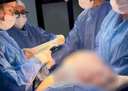 Tumor de 11 kg é retirado de paciente em cirurgia de alta complexidade na fronteira
